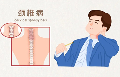 警惕！骨與關(guān)節(jié)的“健康危機(jī)”，你中招了嗎？